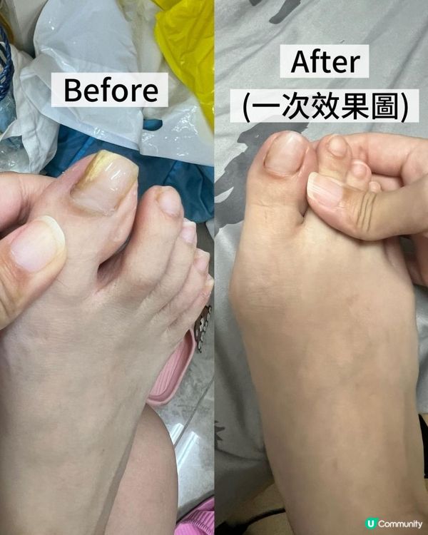 🥰旺角Chill住Gel甲好去處📍