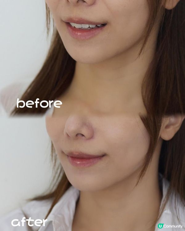 護膚tips✨CurrentBody[六合一光療面膜儀]