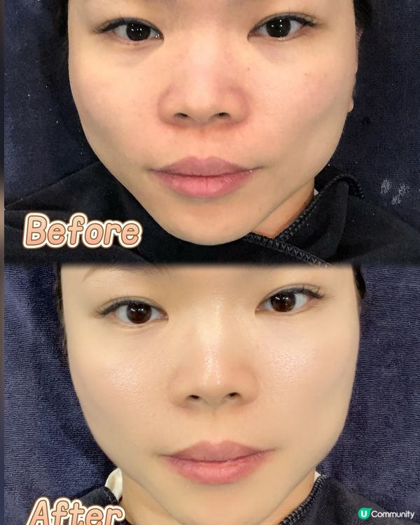 童顏駐是真正從肌膚底層解決美白問題