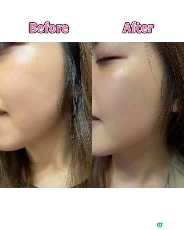 韓國醫美登港！3步打造水光肌✨💧