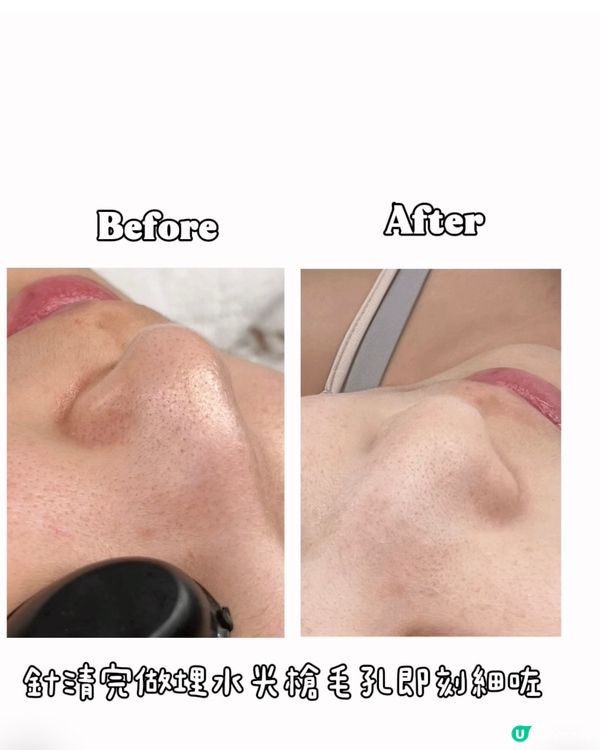 美容院任做放題$8000🤩 靚爆兩個月！🔥