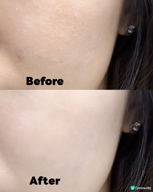 轉季恩物！告別乾敏肌 💧✨ #再生精華