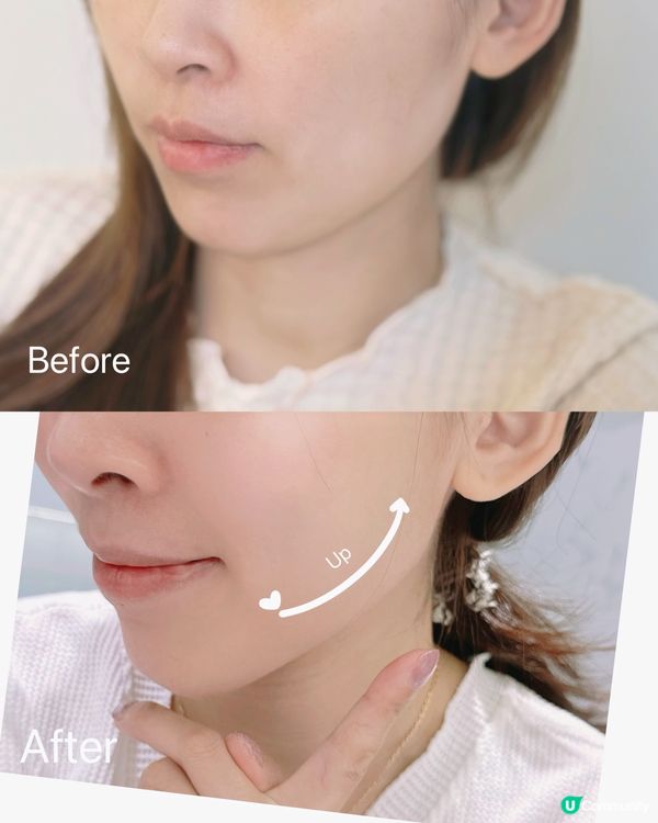 TONYMOLY 14日肌膚重生挑戰！蝸牛精華真係好用🐌