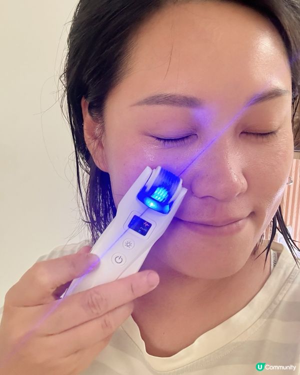 用煥膚MTS收毛孔美容儀堅有效啊！