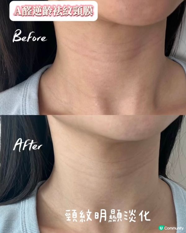 韓國🇰🇷頸膜足膜救星！告別頸紋🦶🏻！