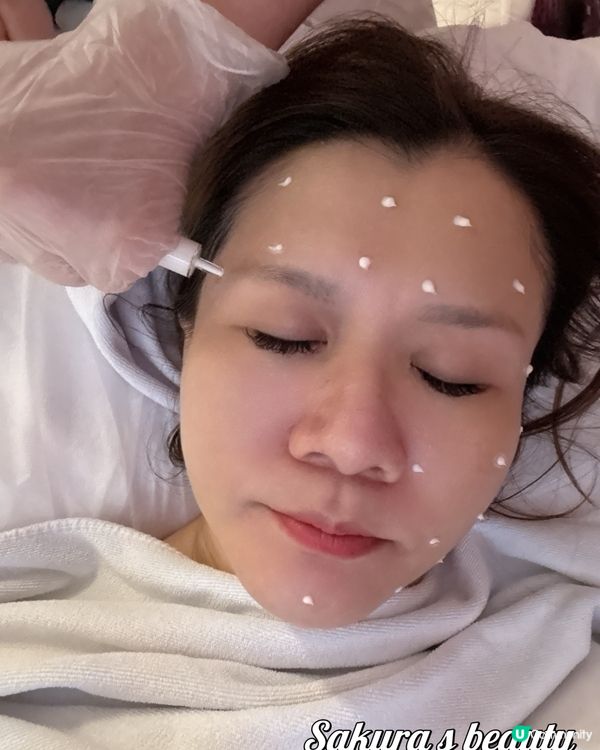 女神針初體驗！✨變靚靚！🤩