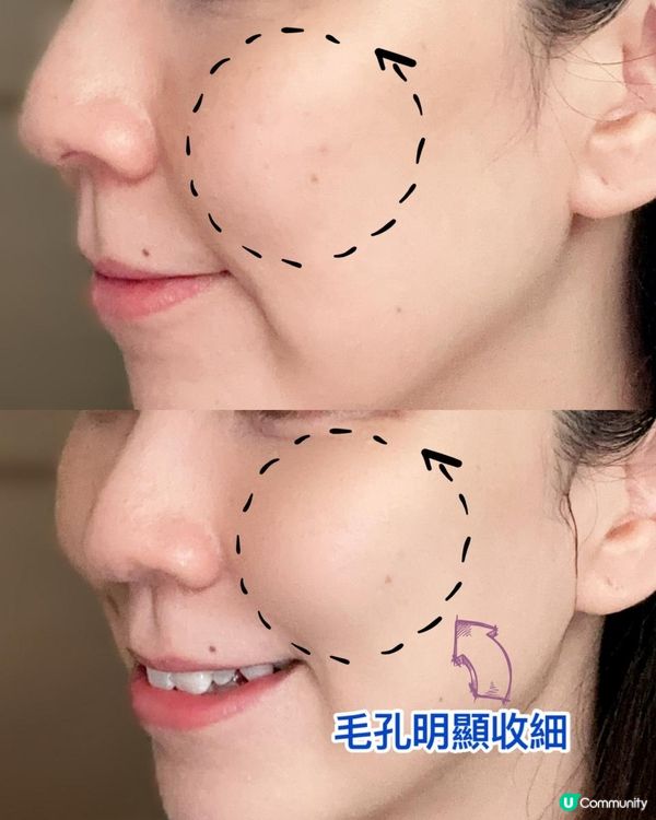 收毛孔神器 ♥ 毛孔拜拜！►Cellology煥膚MTS收毛孔美容儀