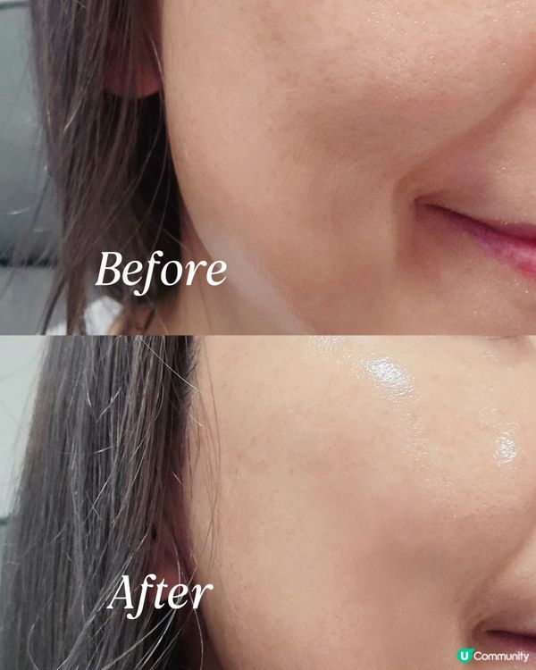 乾燥肌救星！外泌體面膜急救 💧✨ 