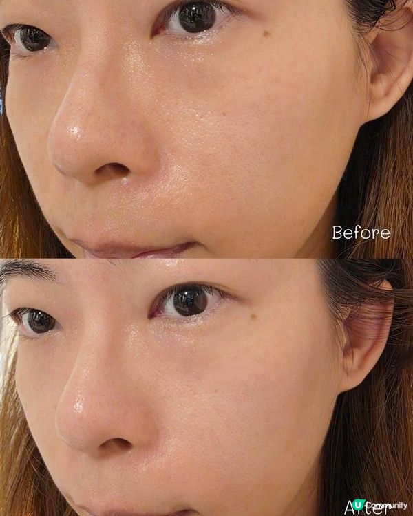 煉成女神水光肌♥外泌體修復面膜