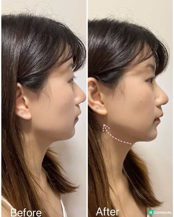 30+ 歲必備！逆齡精華救星！🤩 緊緻輪廓！