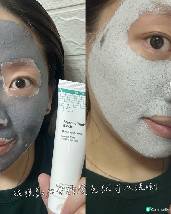 袪痘淡印收毛孔按摩筆