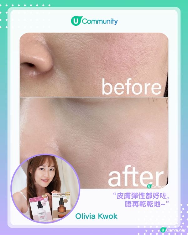 【#UCreator實測報告】PHYSIOGEL皇牌面膜套裝