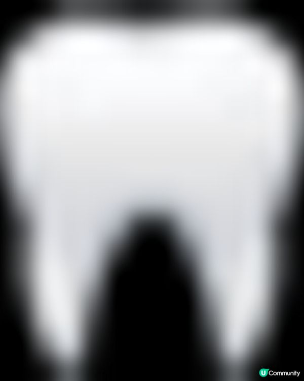 善貝口腔週年慶 | 德國種植牙顆顆半價，終身質保