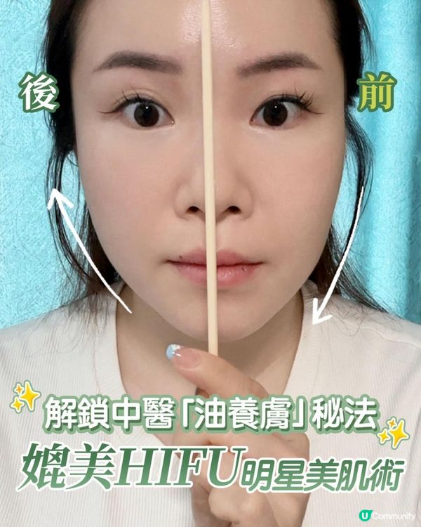 中醫打造V面神技！ 明星級「油養膚」美肌秘訣公開！
