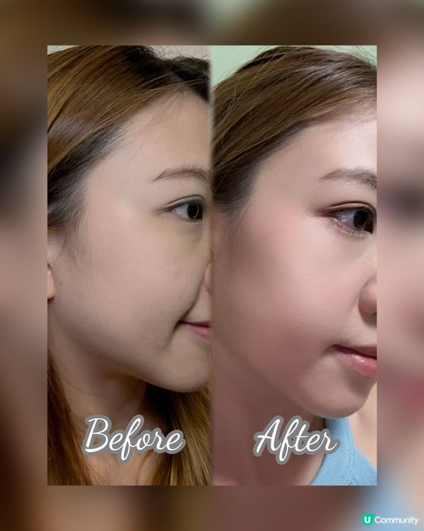 居家專業級美白體驗✨