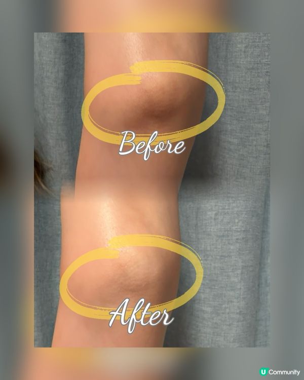 居家專業級美白體驗✨