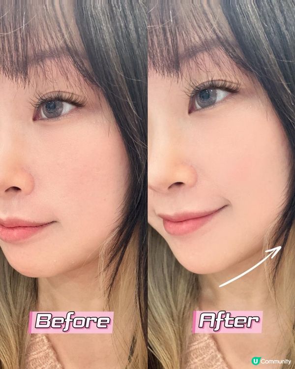 ♡開團優惠❗️Ya-man Ace 系列射頻美容儀♡