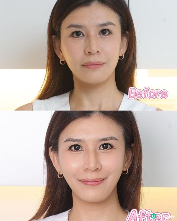 體驗韓式無針水光肌