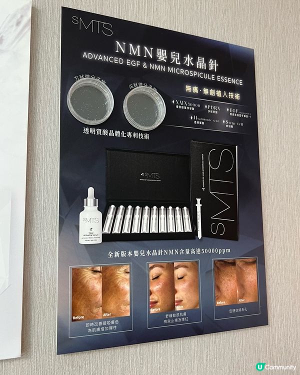 每月必做！嬰兒針2.0🤩 逆齡抗老超正！💧✨