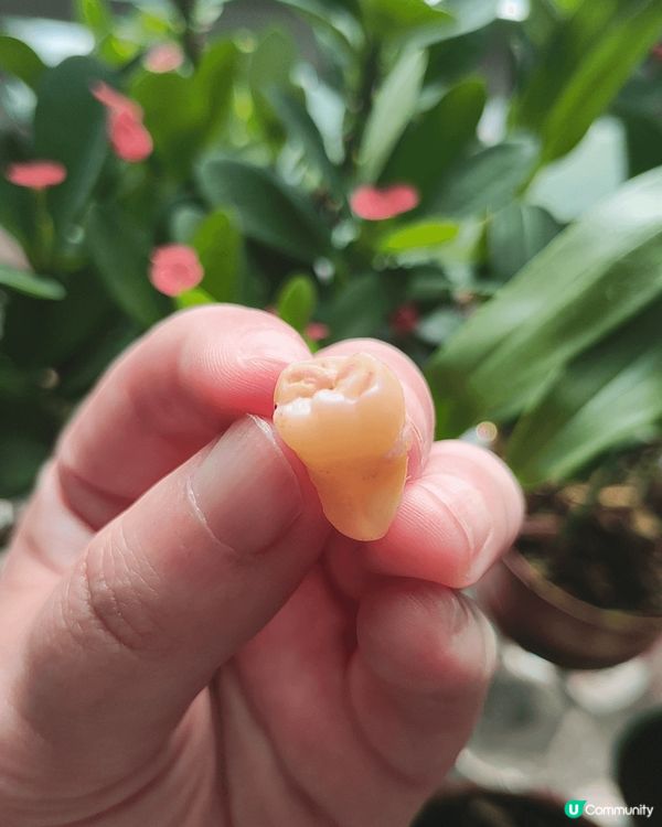 去深圳有10年歷史嘅麥芽牙科洗牙。流程好系統化，包埋照X光。...