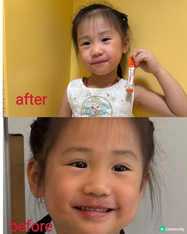 1.  濕敏救星！益生菌幫到手？🤩 媽媽真心分享！