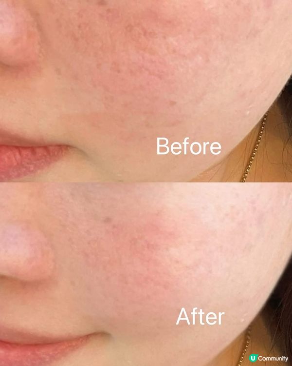 瑞士🇨🇭製造既 Skin Biotics系列絕對系乾性肌救星🫶