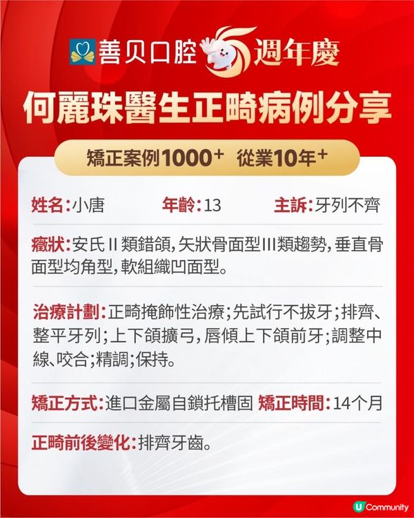 14個月矯治牙齒唔齊整 | 學童箍牙優選深圳善貝口腔