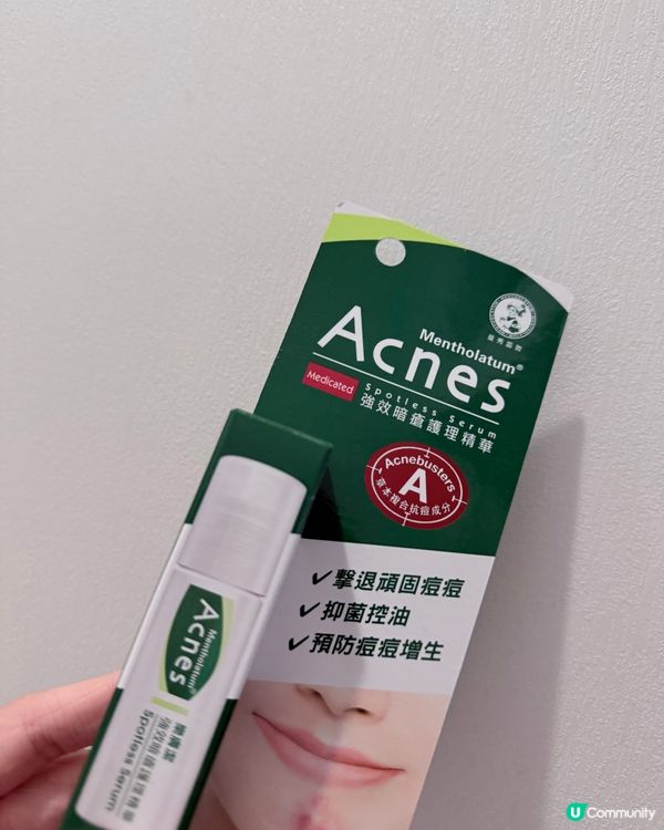 告別痘痘煩惱！