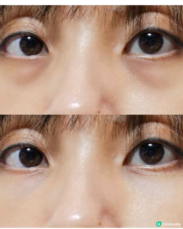 35歲危機🚨？救星級膠原蛋白！✨