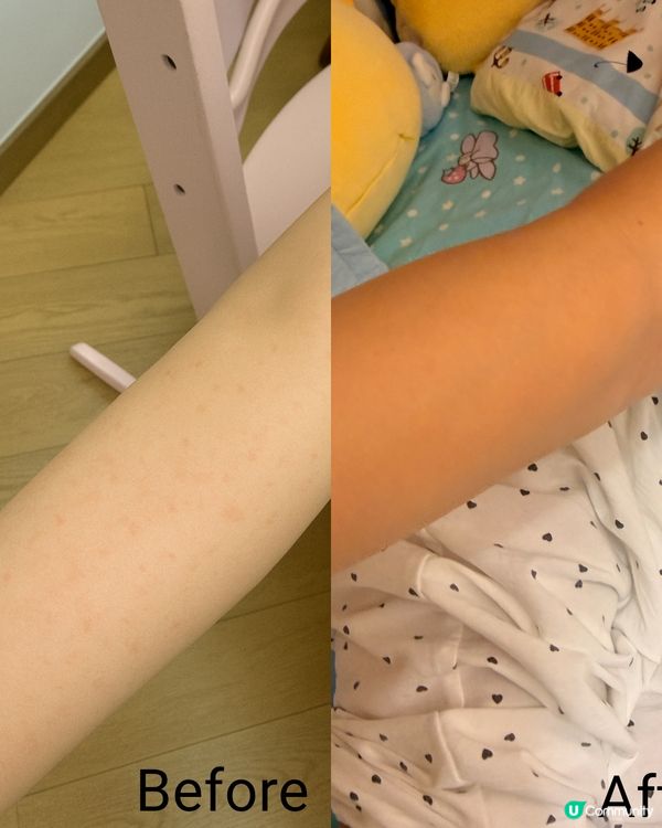 【嘉嘉濕敏ByeBye👋🏻!】3日見效益生菌🤩