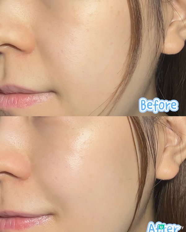 ✨ 要有好肌膚就從情緒管理開始!✨