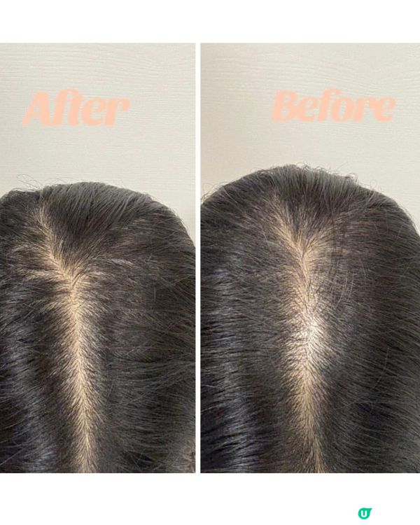 ✨頭髮keep住濃密嘅黑科技!✨