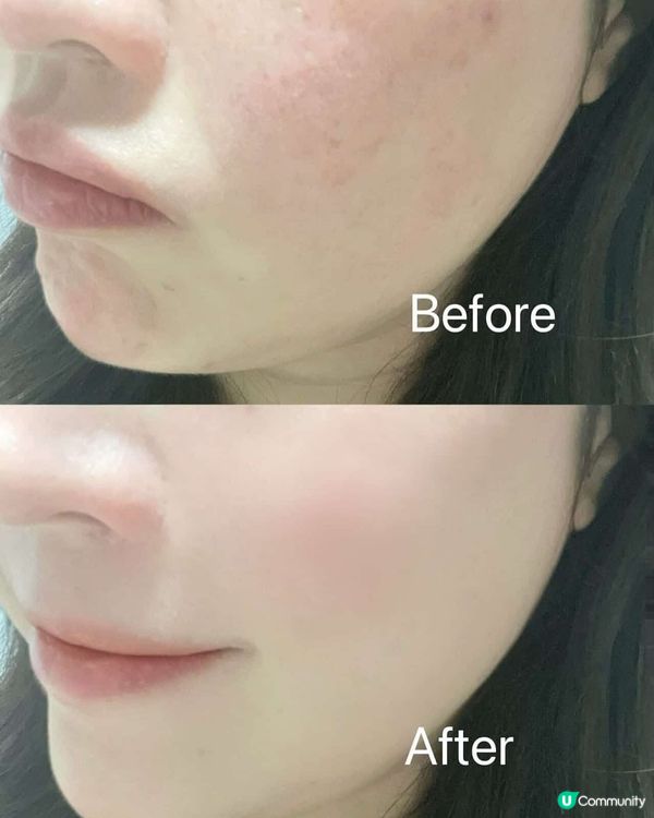 “抗老Combo推薦‼️敏弱老化肌必備💦