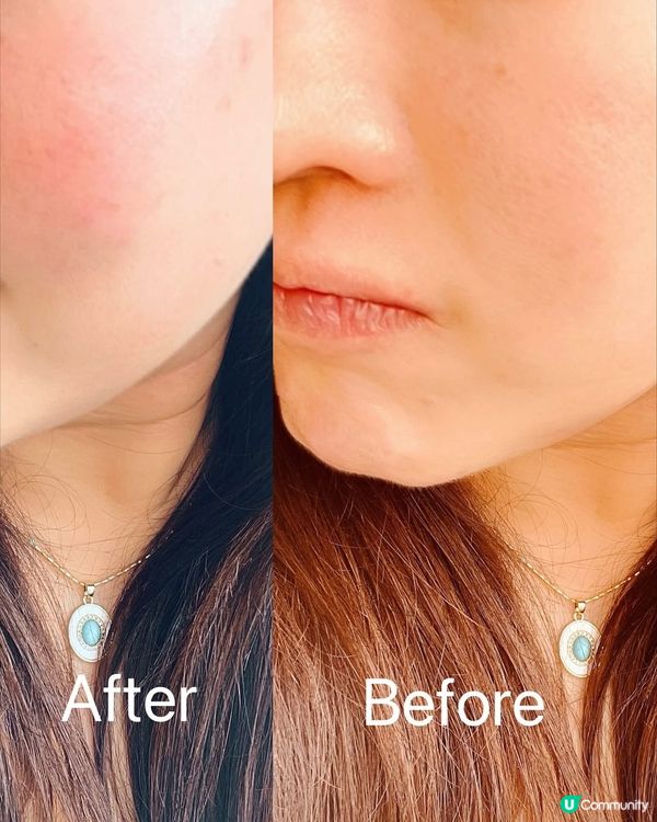 💗重拾年輕光彩嘅秘密💗