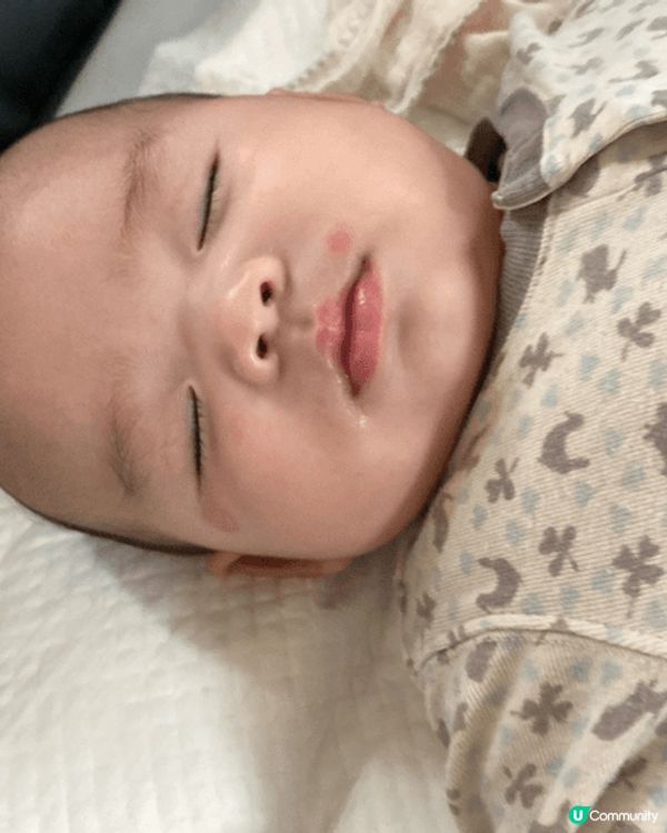 初生Bb臉仔經常濕疹 ，成日好紅！我希望試下AQUA PRO...