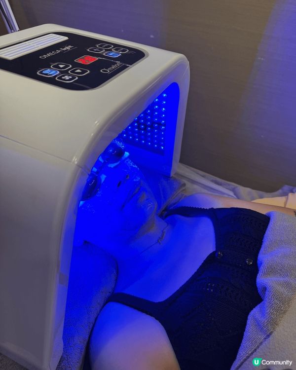 最近生咗好多荷爾蒙瘡，去中醫調理一下，中醫師針對痘痘施美顏針...