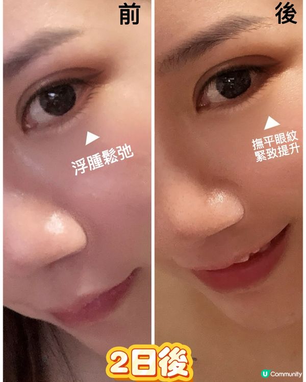 最近轉季又捱夜,照鏡真係嚇親自己😱