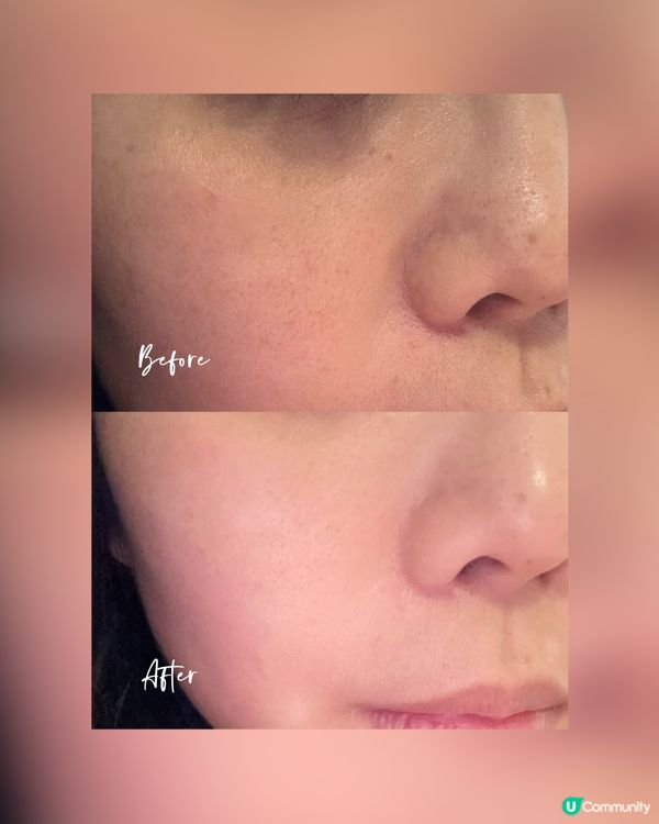 【全年最抵！光療面膜儀🔥】10分鐘變靚！😎