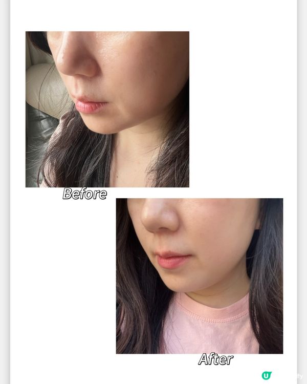 紫蘿蔔精華！2週收毛孔🤩 告別卡粉！