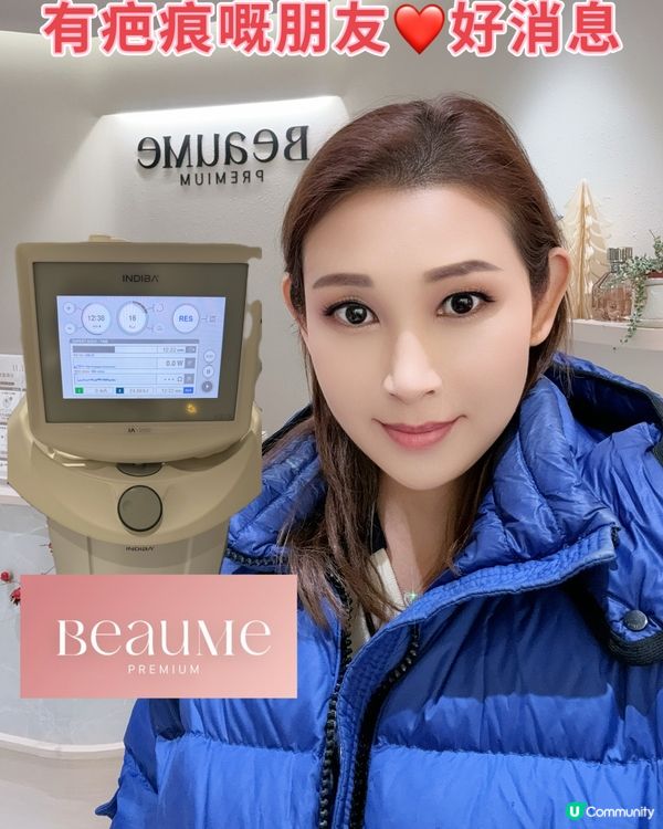 疤痕救星！淡化疤痕初體驗🤩 效果超驚喜！