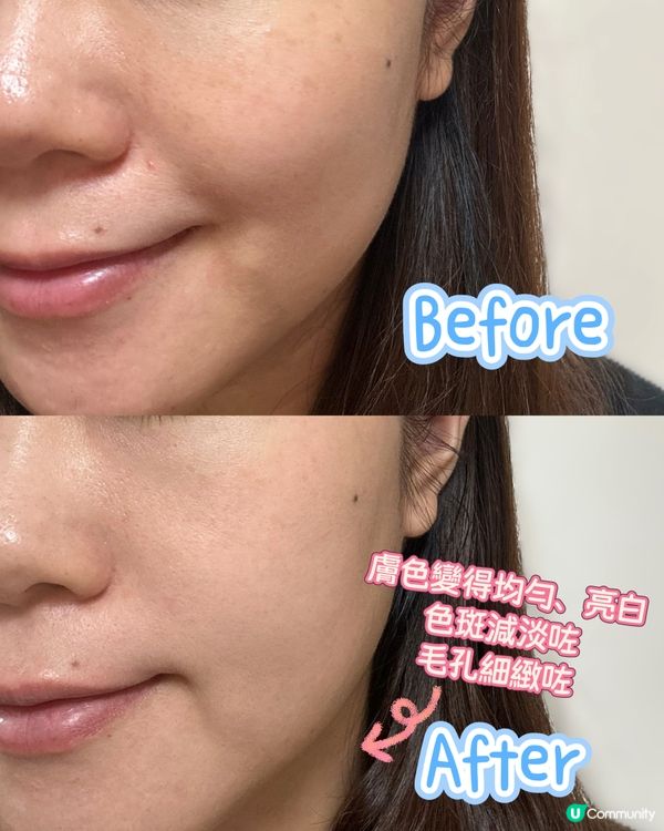 全職媽媽們嘅肌膚救星❤️