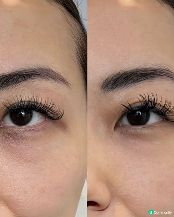 淚溝救星！尖咀美容院初體驗🤩✨