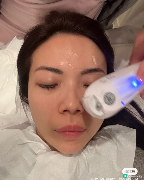 淚溝救星！尖咀美容院初體驗🤩✨