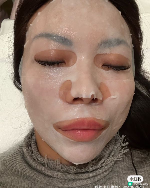 淚溝救星！尖咀美容院初體驗🤩✨