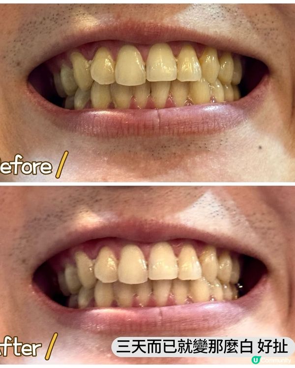 牙黃救星！🦷✨ 齒磨殿堂幫到你！🤩