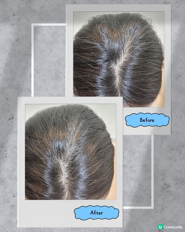 電髮甩頭髮？激推卓營方髮自信👩‍🦰✨