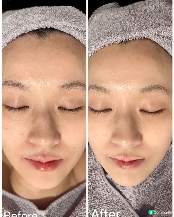 感受菇菌力量🍄-「RNC Beauty 靈芝調理養膚療程」