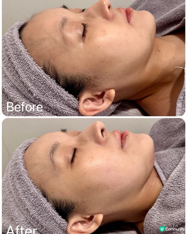 感受菇菌力量🍄-「RNC Beauty 靈芝調理養膚療程」