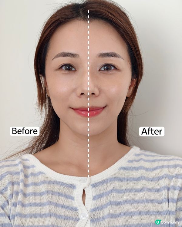 護膚Tips✨ ZIIP HALO風靡荷里活緊膚拉提美容儀