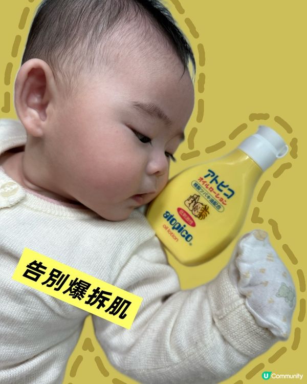 BB皮膚爆拆急救🆘！茶花油潤膚乳液幫到你！👶🏻✨
